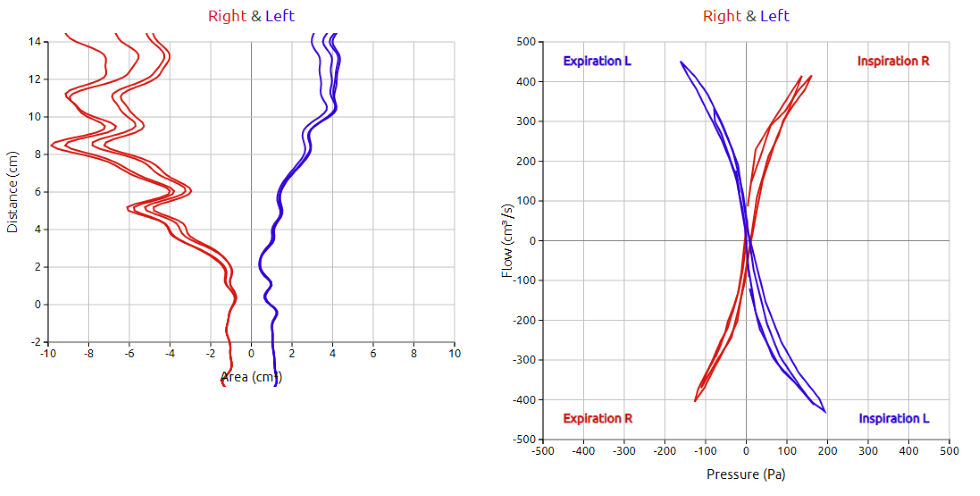 Rhinomanometry and acoustic rhinometry